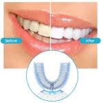 Intelligent Automatic U Type Modes Tooth Brush Sonic Electric Toothbrush USB Rechargeable Tooth Whitening Blue Light 3