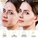 High Frequency Electrotherapy Neon Facial Skin Massage Wand for Acne Skin Rejuvenation Tightening Face Wrinkle Reducing Machine 5