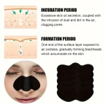 10/50/100 Pieces Deep Cleansing Nose Strips - Clean Pores, Remove Blackheads, Gentle Facial Care Tool 5