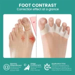 1 Pair Silicone Toe Separator Bunion Corrector Hammer Toe Corrector Soft Silicone Material for Toe Separation Foot Care Tool 3