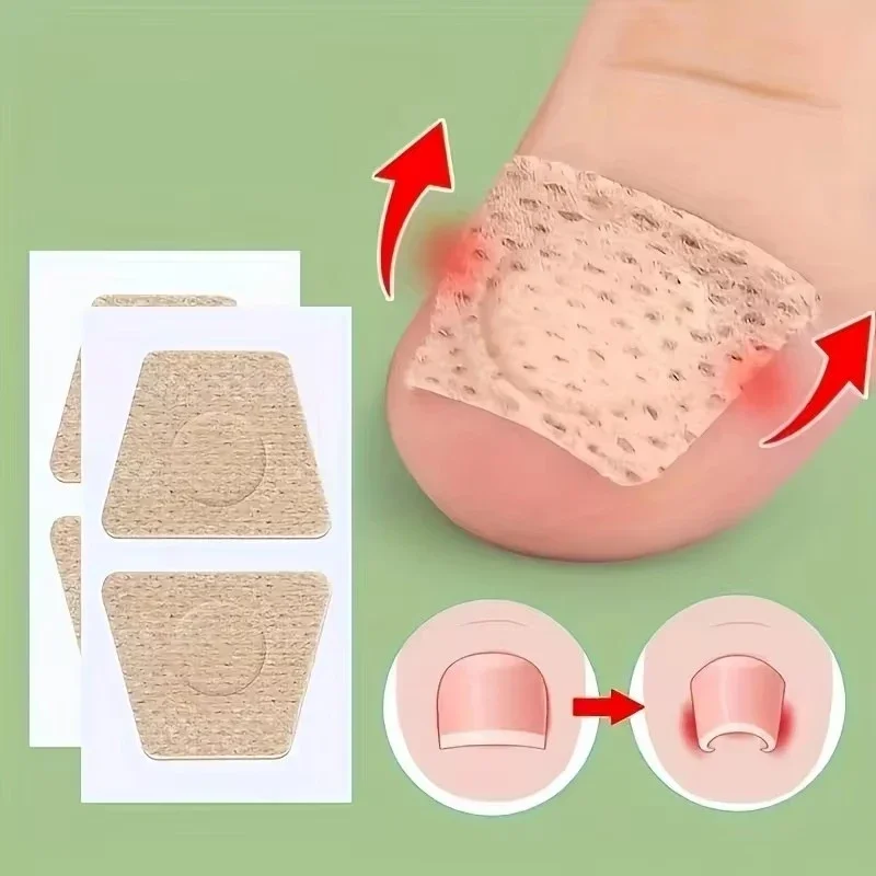 Nail Repair Patch Grey Fungal Nails Thickening Soft Paronychia Treatment Anti Infection Correction Sticker Ingrown Toenail Care Nail Repair Patch Grey Fungal Nails Thickening Soft Paronychia Treatment Anti Infection Correction Sticker Ingrown Toenail Care