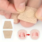 Nail Repair Patch Grey Fungal Nails Thickening Soft Paronychia Treatment Anti Infection Correction Sticker Ingrown Toenail Care 2