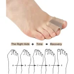 1/2Pc Two Toe Separator Hallux Valgus Bunion Corrector Orthotics Feet Bone Adjuster Thumb Straightener Pedicure Foot Care Tools 6