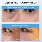 Eye Massager Dark Circles Puffiness Wrinkle Removal Hot Cold Microcurrent Mode Collagen Boosting Eye Fatigue ReliefAntiAgingTool 3
