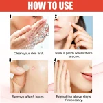 200pcs Star Acne Pimple Patches Colorful Breathable Removal Pimple Absorb Secretions Anti Infection Concealer Makeup Skin Care 4