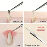 1 Pack Extra Fine No. 5 Cellular Acne Blackhead Tweezers - Facial Beauty Remove Acne Needle Tools for Skin Care 5