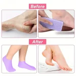 Moisturizing Foot Socks,Silicone Socks for Dry Cracked Feet Women's Foot Socks for Moisturizing,Featuring Massage 5